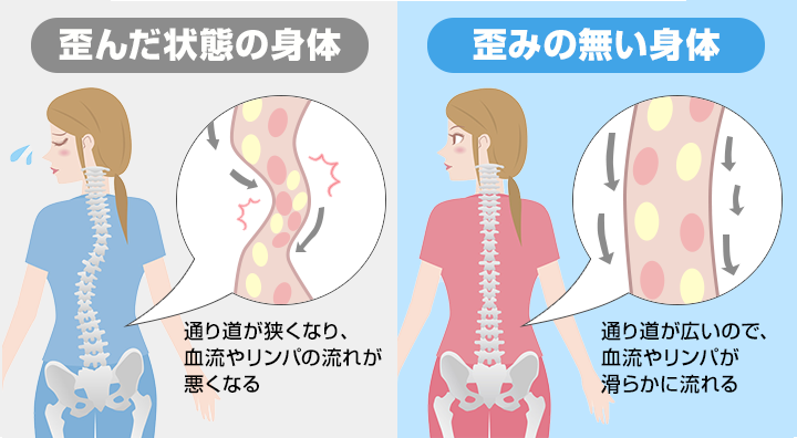 歪んだ状態の体と歪みの無い体の比較
