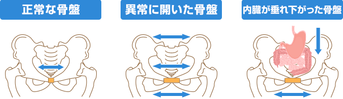そもそもなぜ、骨盤矯正が必要なのか？