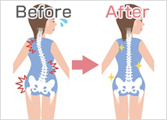 腰痛の本当の原因は？