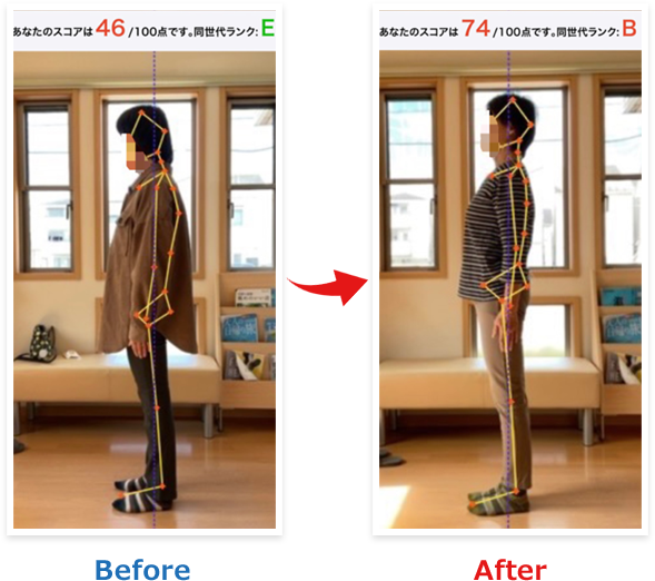 ひどい肩こりがスッキリ!姿勢も改善!