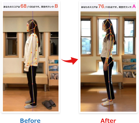 猫背が伸びて腰痛が楽に!